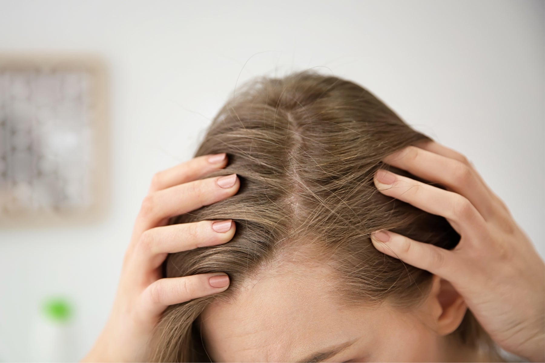 ¿Por qué se cae el pelo?