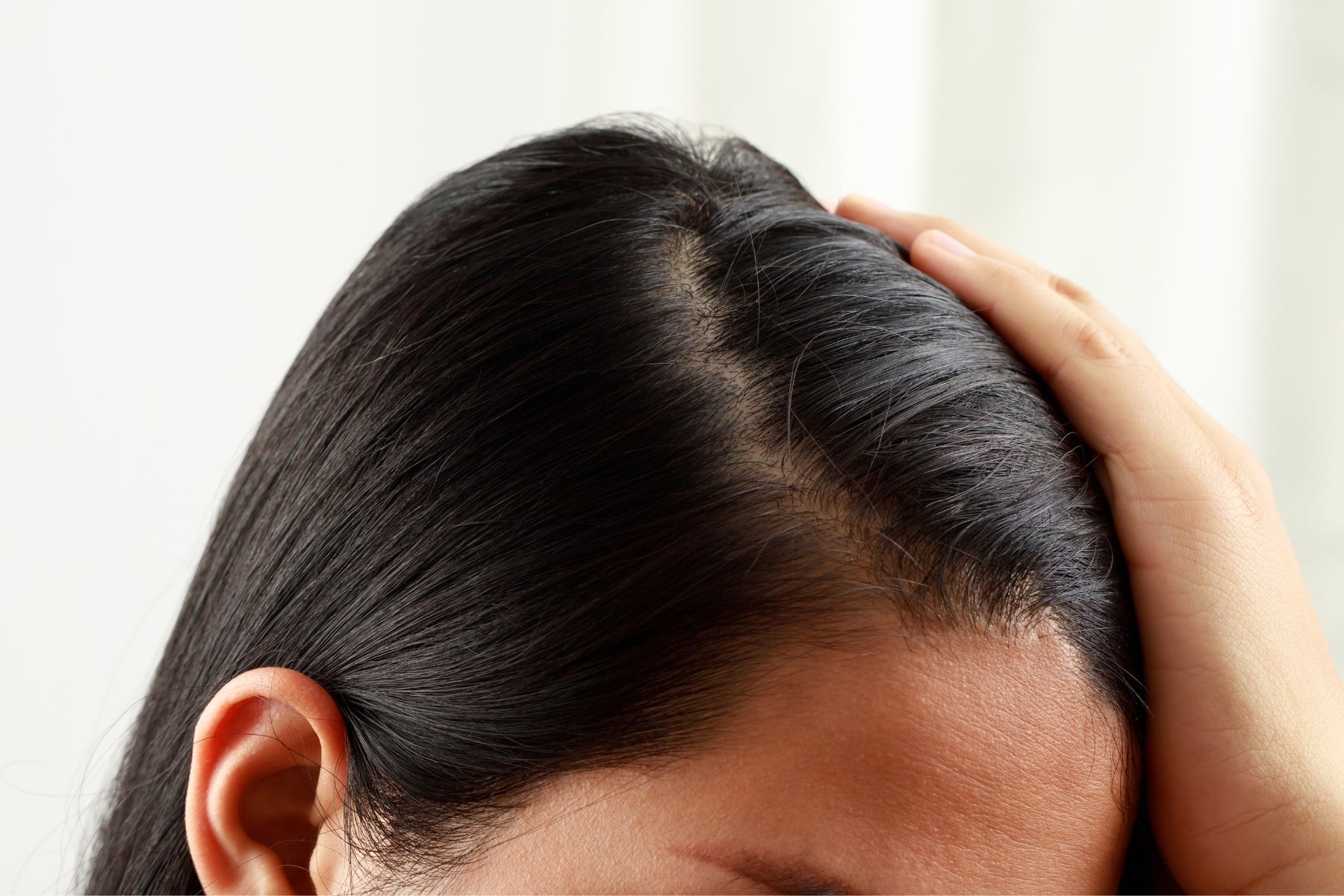 El cuero cabelludo graso: causas, consecuencias y cómo tratarlo de forma eficaz