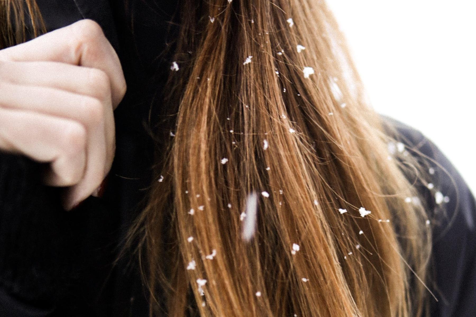 Productos para el cuidado del cabello en invierno