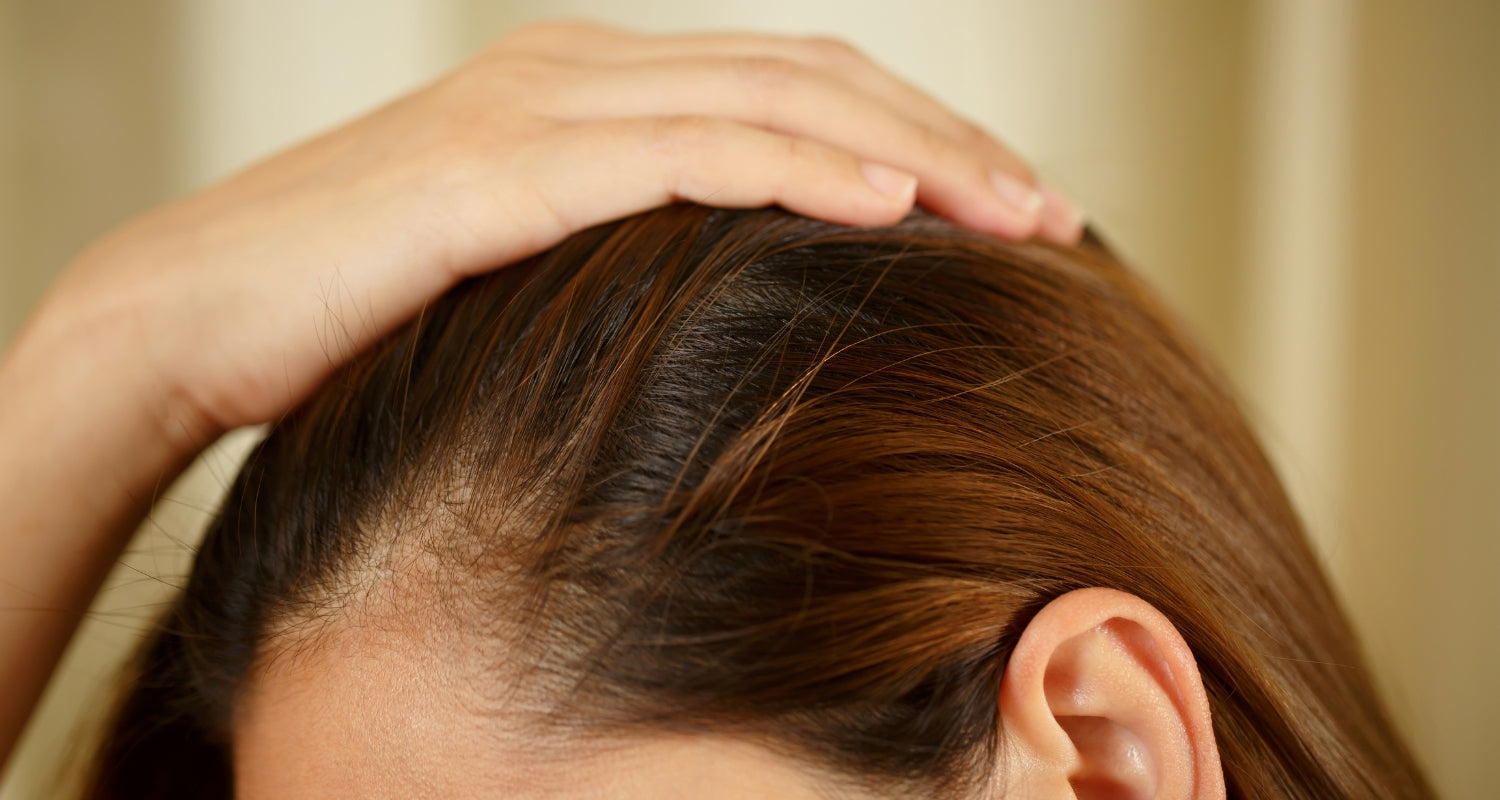 Cuero cabelludo sensible